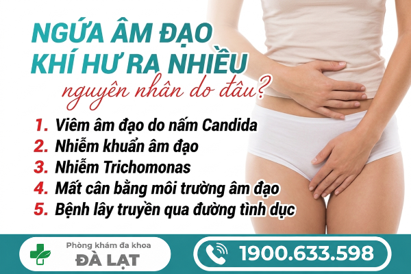 Hình ảnh minh họa